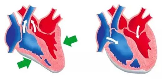 Blutforde normalizes the functioning of the heart and blood vessels